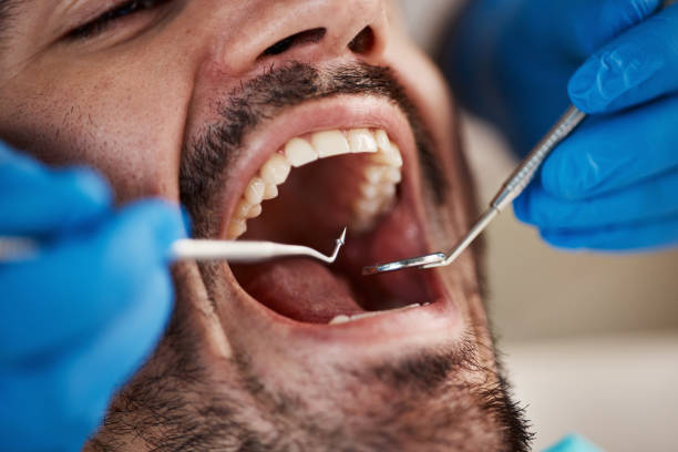 Best Broken or Chipped Tooth Repair in Mentor, OH